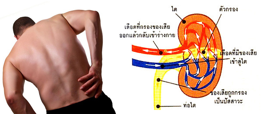 umi-ฉี่มีฟอง-ปวดหลัง-บวม-เหนื่อยง่าย-ค่าไตสูง-ไตเริ่มเสื่อม-ฟอกไต-ไม่อยากฟอกไต-ยารักษา-โรคไต
