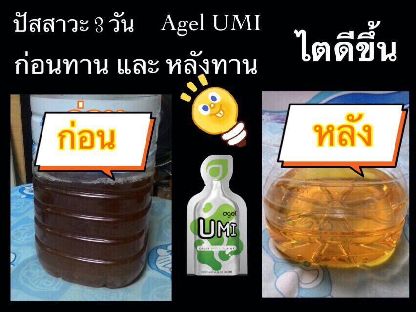 ไตเสื่อม-ไตวาย-ฟอกไต-ไตเรื้อรัง-กินอะไรดี-ผลไม้-ผัก-อาหารเสริม-อะไรดี-เอเจล-umi-agel-ไตเสื่อม-ยารักษาไต-อาหารเสริม-บำรุงไต-อาการ-โรคไต-หายได้ไหม-อาการ-โรคไต-รักษาได้ไหม-รักษาหายไหม-ยารักษาโรคไต-umi-เห็ดหลินจือแดง-ไข่ขาวผง-อัลบูมิน
