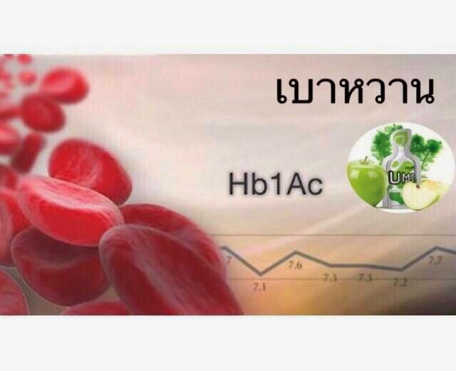 gelsociety-Kidney-Fucoidan-agel-umi-มะเร็ง-อาเจล-เอเจล-รักษา-ราคาถูก-ราคาสมาชิก-สมัครทำธุรกิจ-ไตเสื่อม-อูมิ-เบาหวาน-ajel-เบาหวาน-คีโม-เพิ่มเม็ดเลือดขาว-cea-กินข้าวไม่ได้-อาหารเสริม-เก๊าส์-umi-grn-agel-uric-acid-อาเจล-ข้อบวม-ยูริค-ยูริก-เก๊าท์-เก๊า-รักษา-ยังไง-หายไหม-อูมิ-อะไรดี-อาหารเสริม-เก๊าท์-ลดกรดยูริค-ปวดข้อ-ปวดเข่า-กรดยูริคสูง-umi-grn-agel-โรคเก๊าท์-ซื้อเอง-ออฟฟิศ-กรุงเทพ-ราคาสมาชิก-สมัคร-ตัวแทน-ทำธุรกิจ-แม่ทีม-ผู้นำระดับสูง-ไตเสื่อม-ไตวาย-ฟอกไต-ไตเรื้อรัง-กินอะไรดี-ผลไม้-ผัก--เจ-จอย-ริน-24gel-gel-treat อาหารเสริม-อะไรดี-เอเจล-umi-agel-ไตเสื่อม-ยารักษาไต-อาหารเสริม-บำรุงไต-อาการ-โรคไต-หายได้ไหม-อาการ-โรคไต-รักษาได้ไหม-รักษาหายไหม-ยารักษาโรคไต-umi-เห็ดหลินจือแดง
